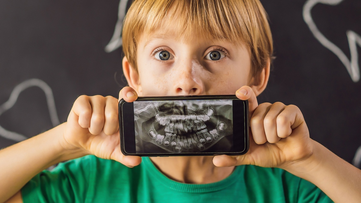 Čip, který vám umožní vidět pomocí rentgenových paprsků, jako byste byli „Superman“, je realitou a můžete ho mít ve svém mobilním telefonu.